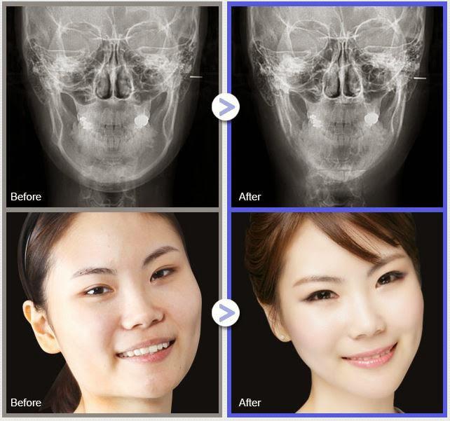 Пластическая хирургия в южной Корее