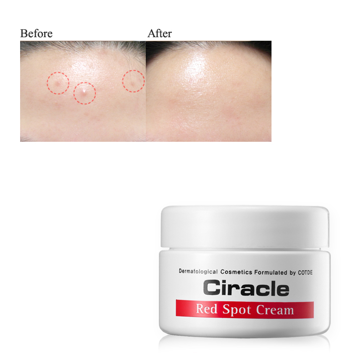Крем для проблемной кожи Ciracle Red Spot Cream 46298806 - фото 3