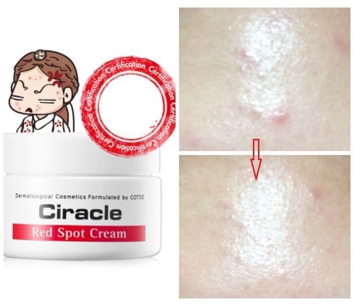 Крем для проблемной кожи Ciracle Red Spot Cream 46298806 - фото 2