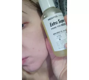 Фото отзыв о MEDI-PEEL Extra Super 9 Plus Pore Tox Cleanser