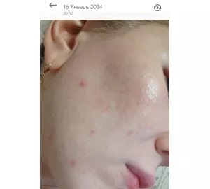 Фото отзыв о MEDI-PEEL Extra Super 9 Plus Pore Tox Cleanser