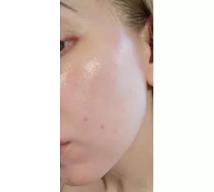 Фото отзыв о MEDI-PEEL Melanon X Drop Gel Cream