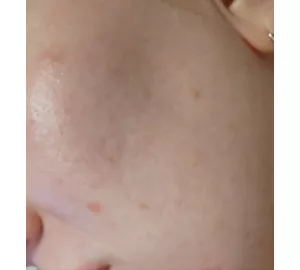 Фото отзыв о MEDI-PEEL Melanon X Drop Gel Cream