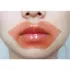 Berrisom Sos My Lip Patch