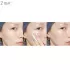 CosRX One Step Pimple Clear Kit