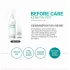 Lador Before Keratin PPT
